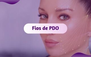 fios de pdo