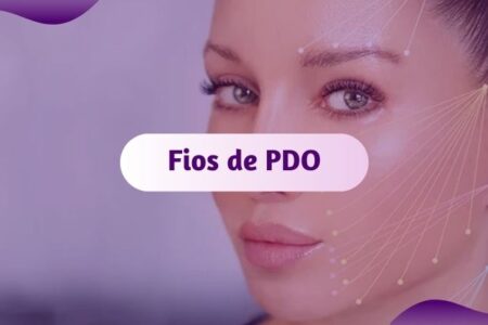 fios de pdo