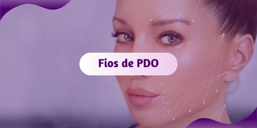 Fios de Sustentação (PDO) o Lifting NÃO cirurgico - saiba TUDO sobre!