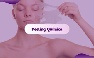 peeling quimico