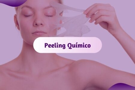 peeling quimico