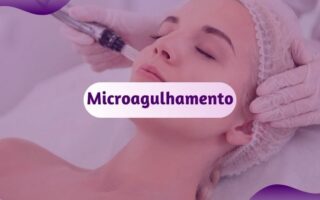 microagulhamento